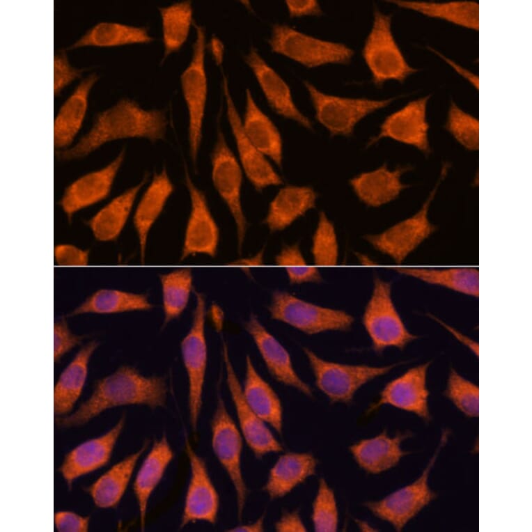 Immunofluorescence - Anti-GOLPH3/MIDAS Antibody (A89536) - Antibodies.com