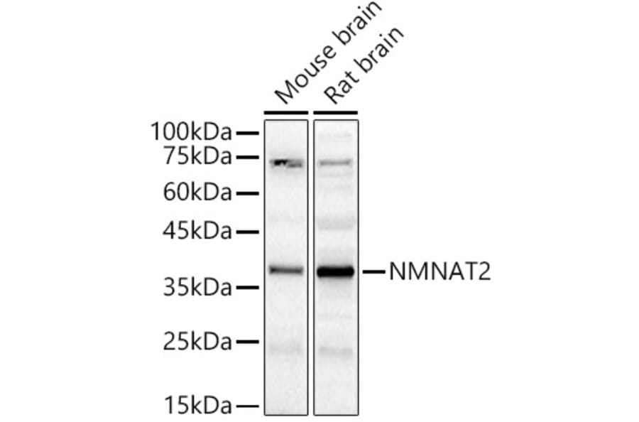 Western Blot - Anti-NMNAT2 Antibody (A89537) - Antibodies.com