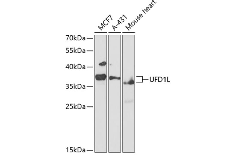Western Blot - Anti-UFD1L Antibody (A89538) - Antibodies.com