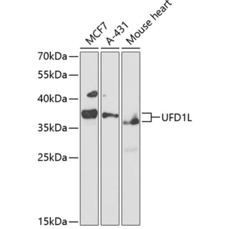 Western Blot - Anti-UFD1L Antibody (A89538) - Antibodies.com