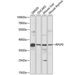 Western Blot - Anti-RPLP0 Antibody (A89539) - Antibodies.com