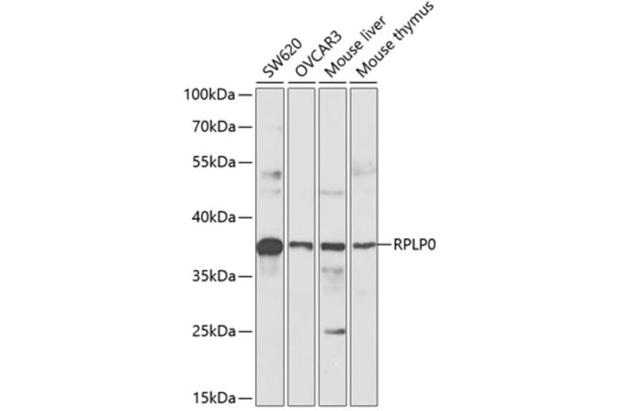 Western Blot - Anti-RPLP0 Antibody (A89539) - Antibodies.com