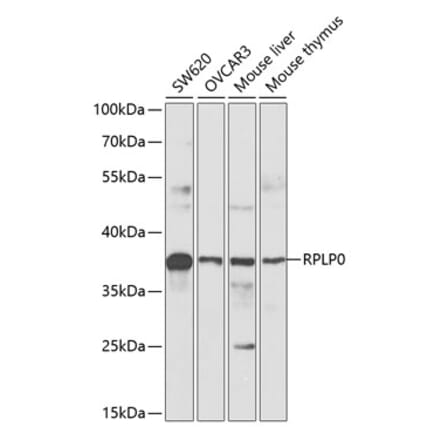 Western Blot - Anti-RPLP0 Antibody (A89539) - Antibodies.com