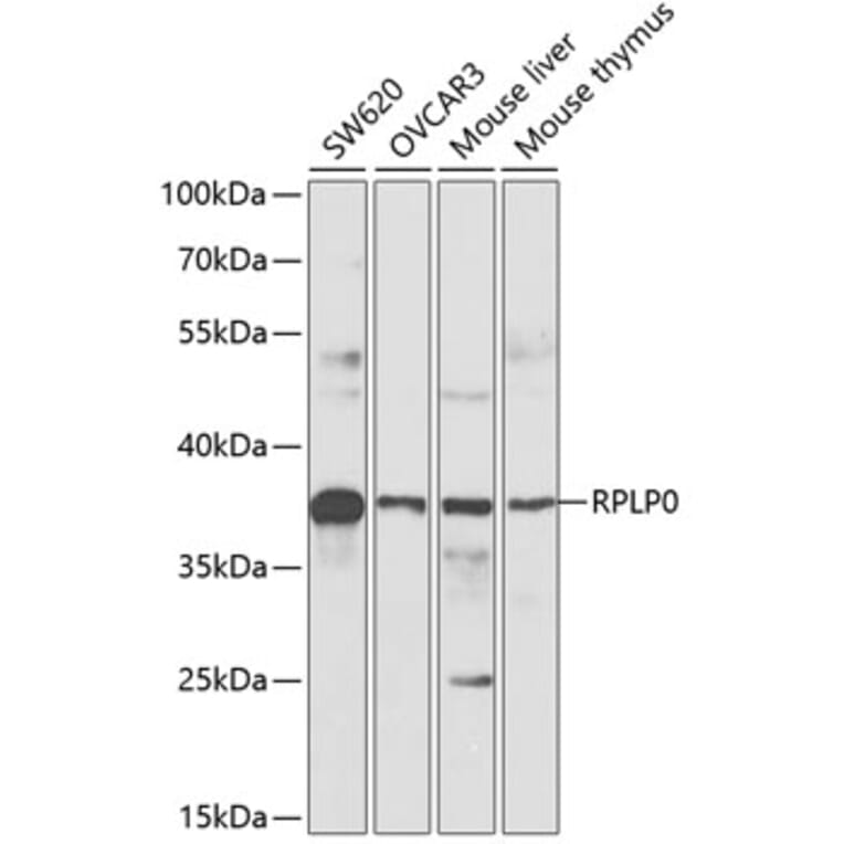 Western Blot - Anti-RPLP0 Antibody (A89539) - Antibodies.com