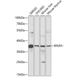 Western Blot - Anti-RPLP0 Antibody (A89539) - Antibodies.com