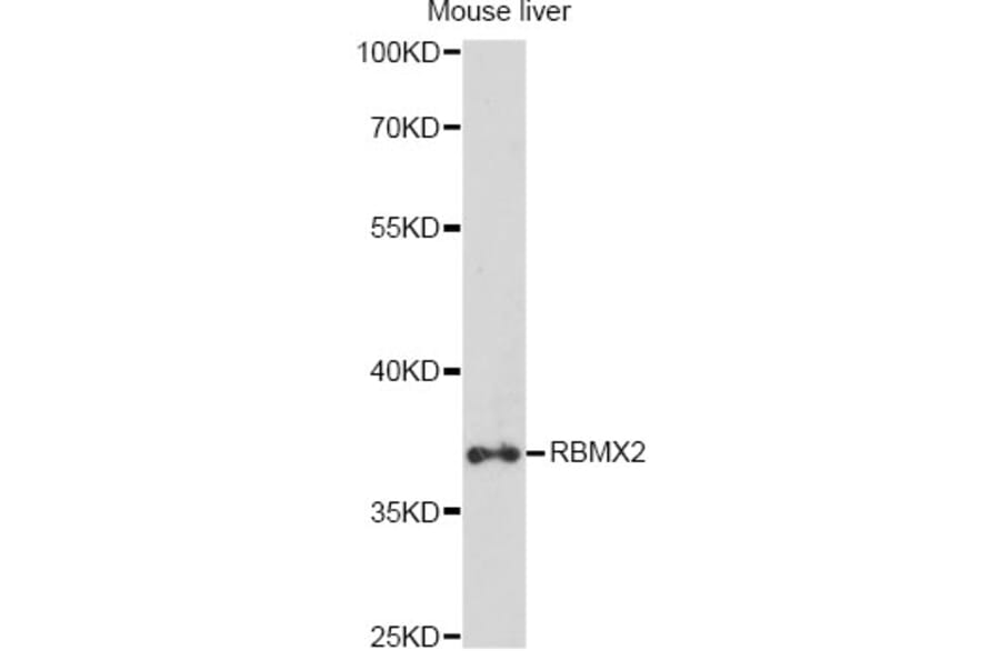 Western Blot - Anti-RBMX2 Antibody (A14321) - Antibodies.com