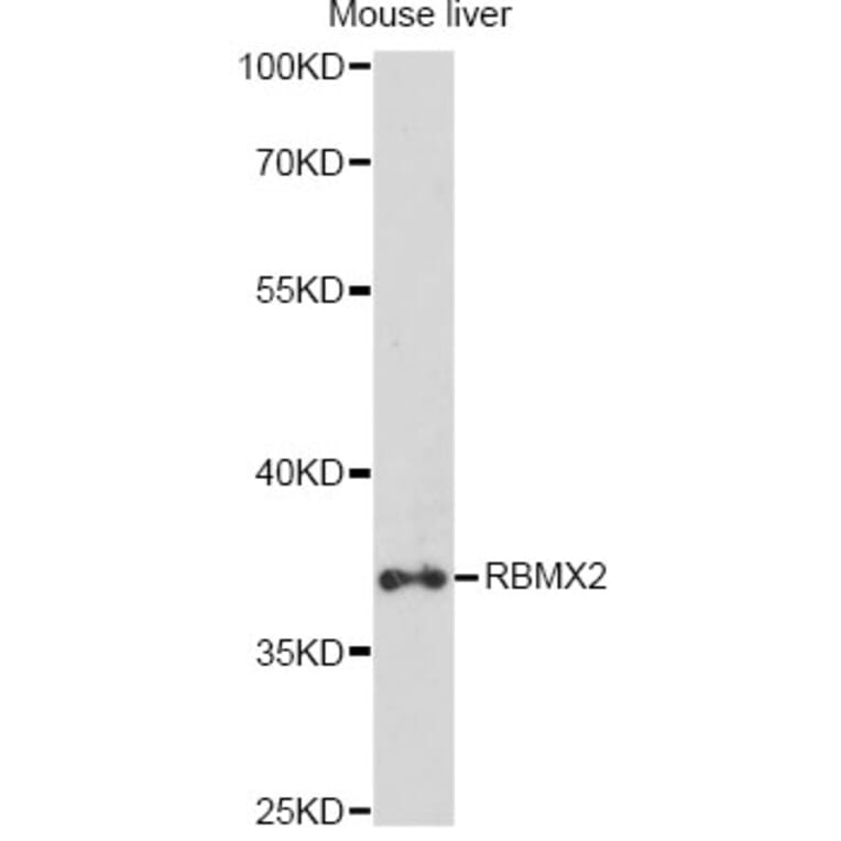 Western Blot - Anti-RBMX2 Antibody (A14321) - Antibodies.com