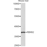 Western Blot - Anti-RBMX2 Antibody (A14321) - Antibodies.com