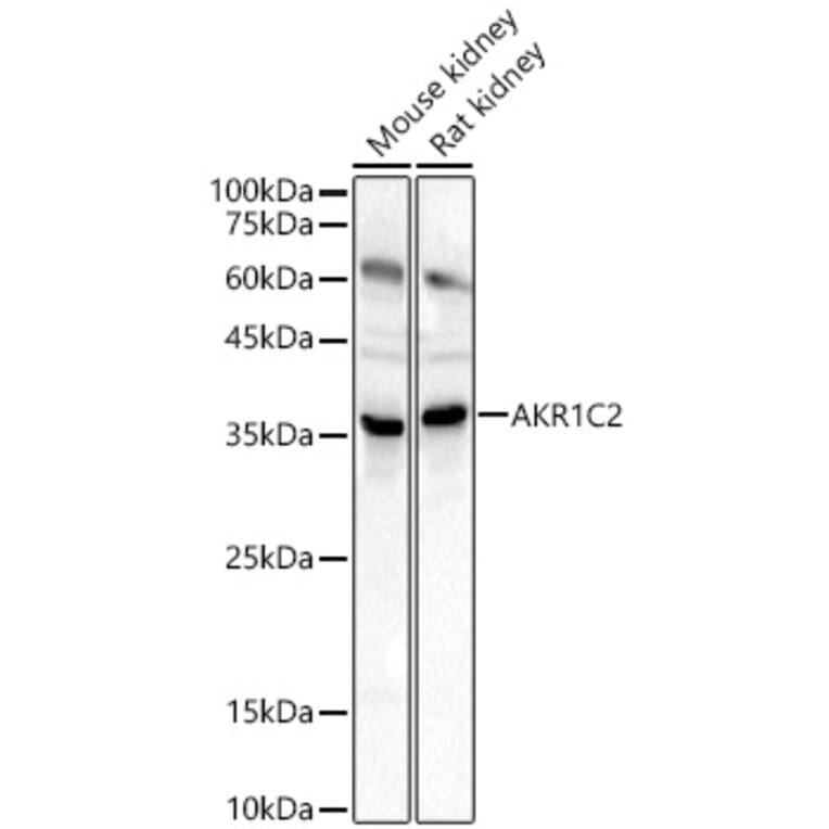 Western Blot - Anti-AKR1C1/AKR1C2 Antibody (A89541) - Antibodies.com