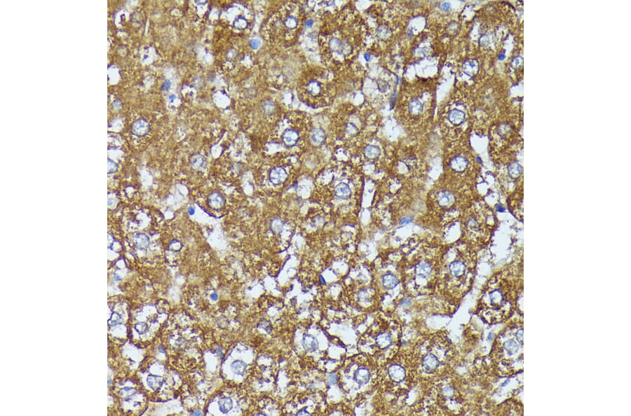 Immunohistochemistry - Anti-AKR1C1/AKR1C2 Antibody (A89541) - Antibodies.com