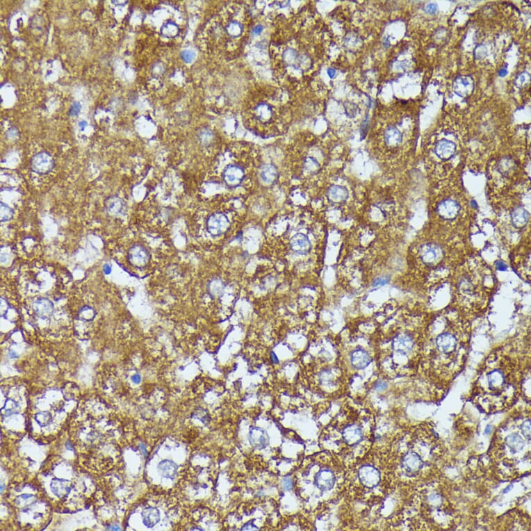 Immunohistochemistry - Anti-AKR1C1/AKR1C2 Antibody (A89541) - Antibodies.com