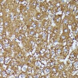 Immunohistochemistry - Anti-AKR1C1/AKR1C2 Antibody (A89541) - Antibodies.com
