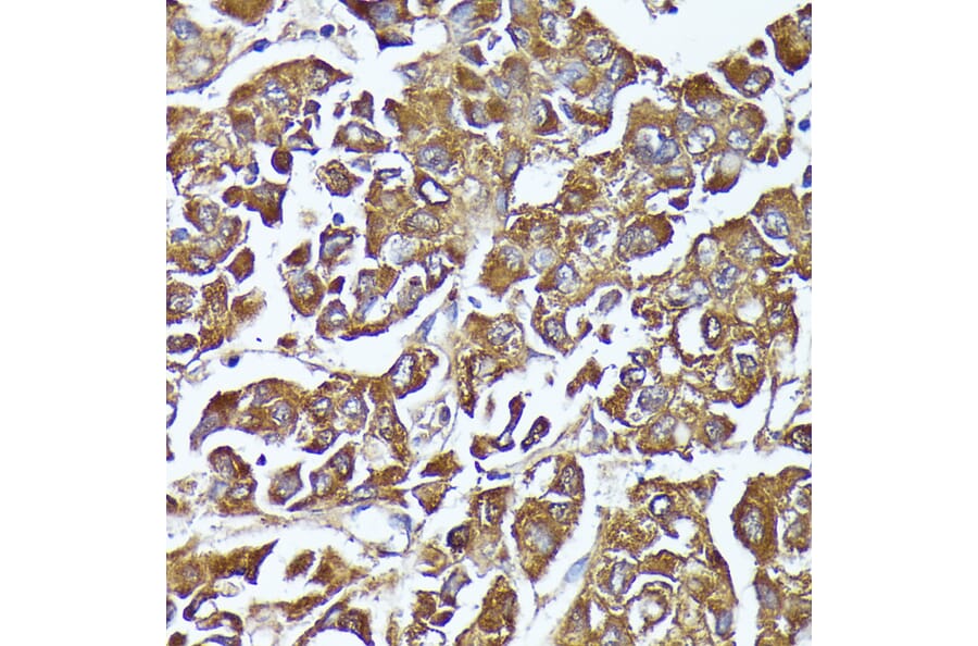Immunohistochemistry - Anti-AKR1C1/AKR1C2 Antibody (A89541) - Antibodies.com