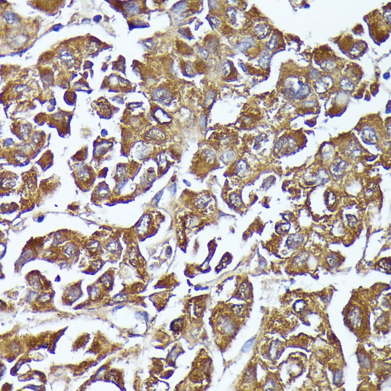 Immunohistochemistry - Anti-AKR1C1/AKR1C2 Antibody (A89541) - Antibodies.com