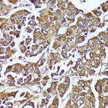 Immunohistochemistry - Anti-AKR1C1/AKR1C2 Antibody (A89541) - Antibodies.com
