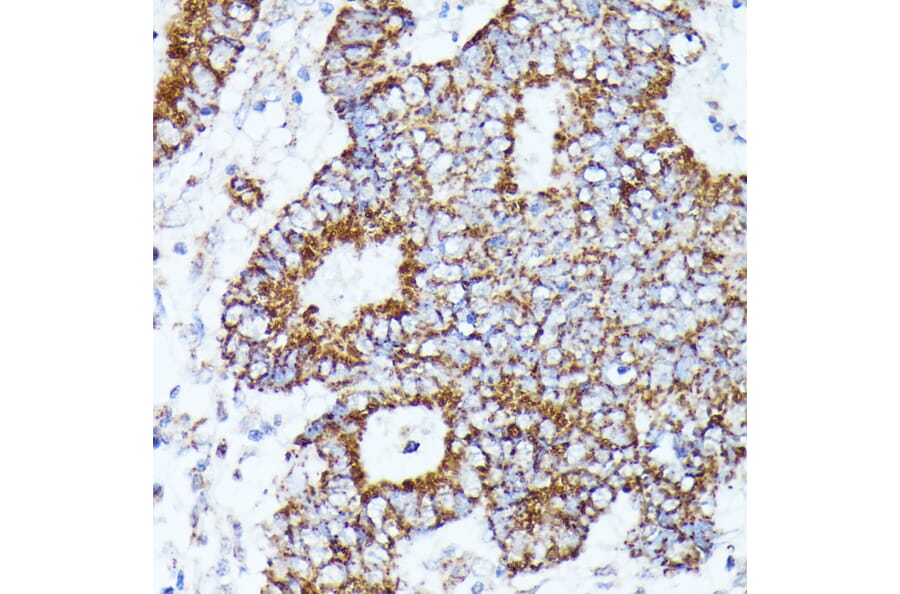 Immunohistochemistry - Anti-AKR1C1/AKR1C2 Antibody (A89541) - Antibodies.com