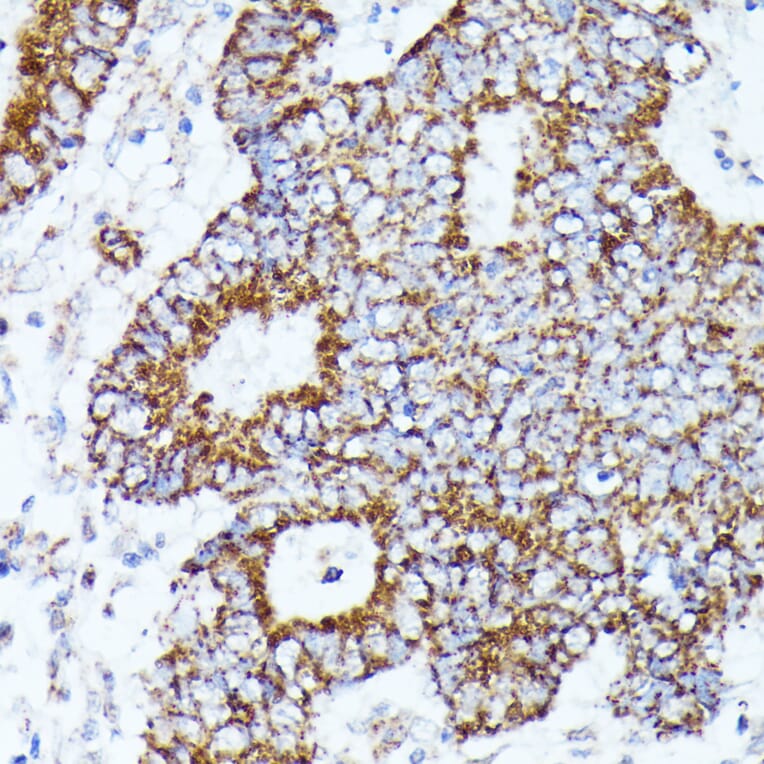 Immunohistochemistry - Anti-AKR1C1/AKR1C2 Antibody (A89541) - Antibodies.com