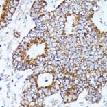 Immunohistochemistry - Anti-AKR1C1/AKR1C2 Antibody (A89541) - Antibodies.com