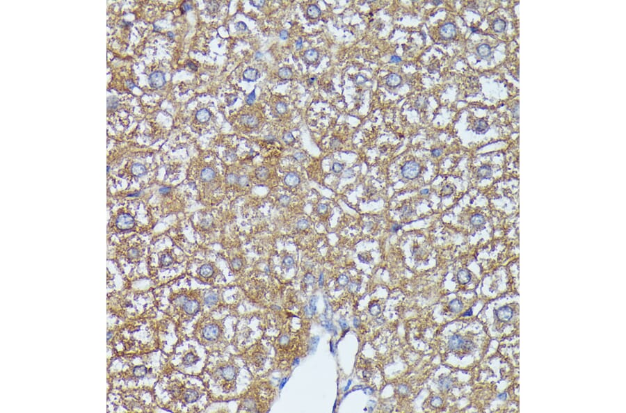 Immunohistochemistry - Anti-AKR1C1/AKR1C2 Antibody (A89541) - Antibodies.com