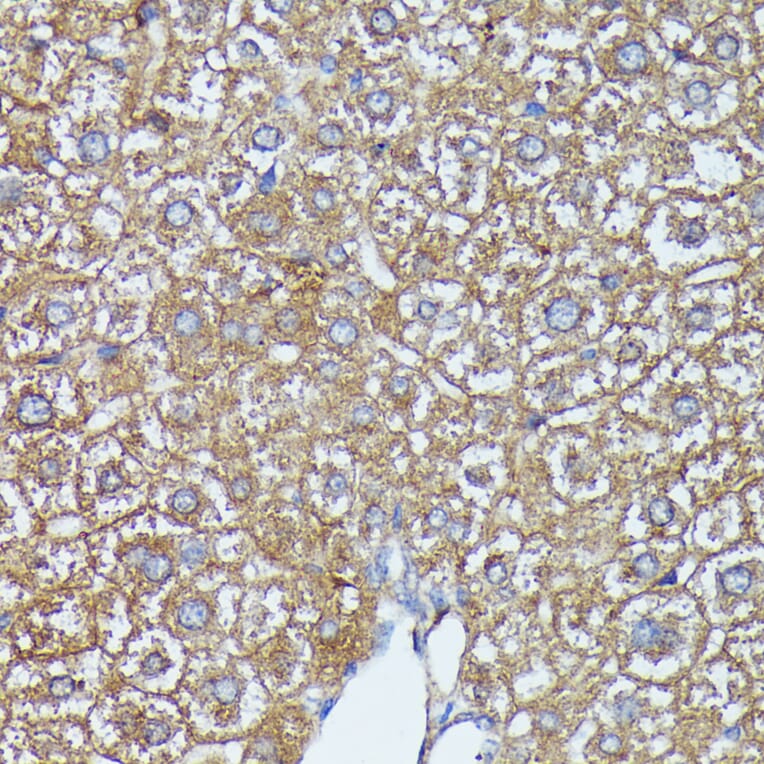 Immunohistochemistry - Anti-AKR1C1/AKR1C2 Antibody (A89541) - Antibodies.com