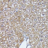 Immunohistochemistry - Anti-AKR1C1/AKR1C2 Antibody (A89541) - Antibodies.com