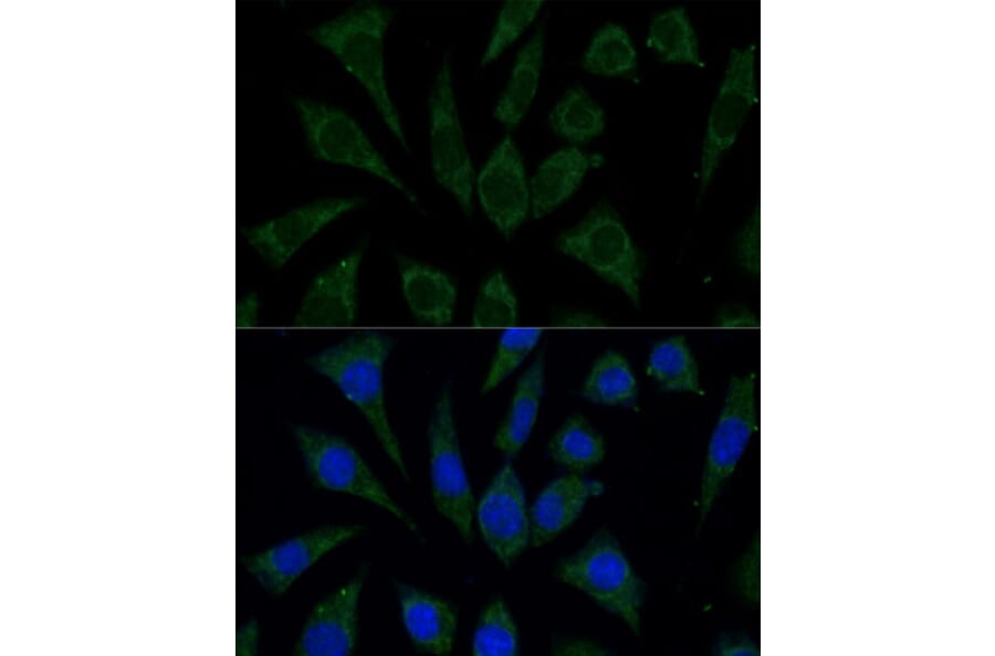 Immunofluorescence - Anti-AKR1C1/AKR1C2 Antibody (A89541) - Antibodies.com