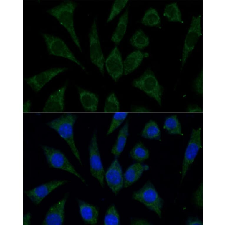 Immunofluorescence - Anti-AKR1C1/AKR1C2 Antibody (A89541) - Antibodies.com