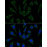 Immunofluorescence - Anti-AKR1C1/AKR1C2 Antibody (A89541) - Antibodies.com