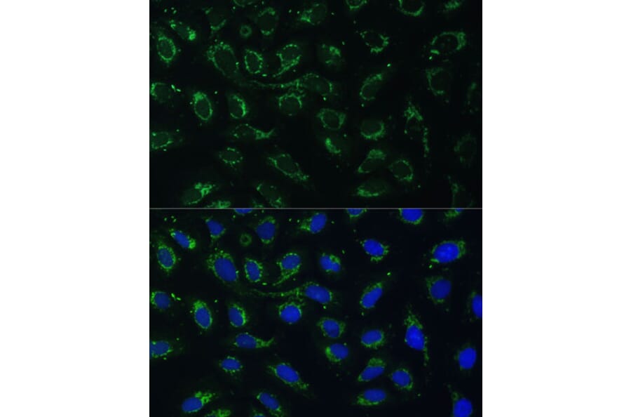 Immunofluorescence - Anti-AKR1C1/AKR1C2 Antibody (A89541) - Antibodies.com