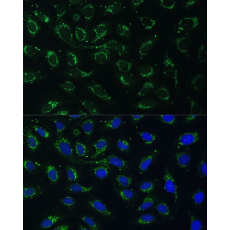 Immunofluorescence - Anti-AKR1C1/AKR1C2 Antibody (A89541) - Antibodies.com