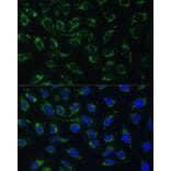 Immunofluorescence - Anti-AKR1C1/AKR1C2 Antibody (A89541) - Antibodies.com