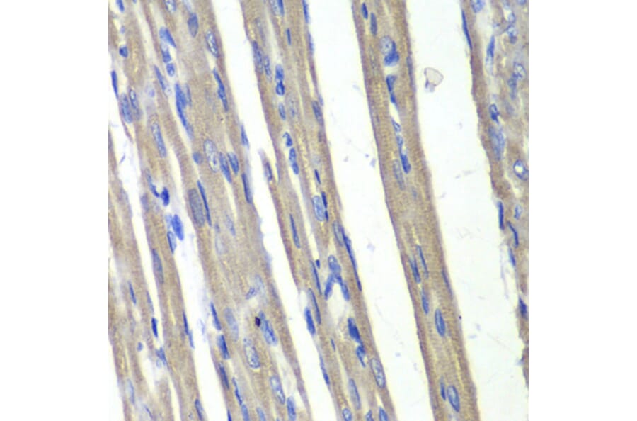 Immunohistochemistry - Anti-AKR1C3 Antibody (A89542) - Antibodies.com