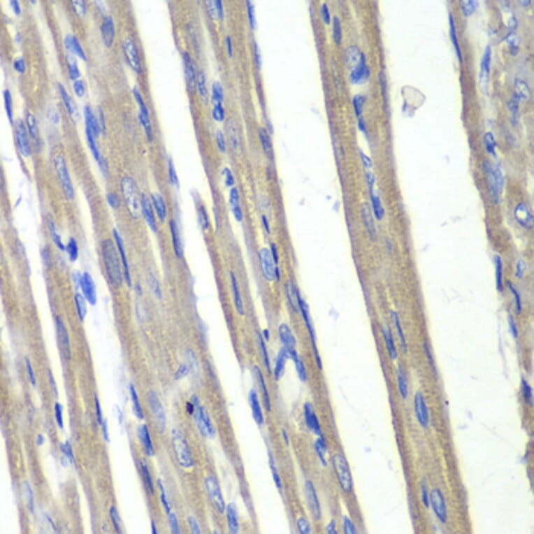 Immunohistochemistry - Anti-AKR1C3 Antibody (A89542) - Antibodies.com