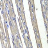 Immunohistochemistry - Anti-AKR1C3 Antibody (A89542) - Antibodies.com