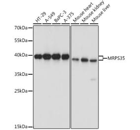 Western Blot - Anti-MRPS35 Antibody (A89543) - Antibodies.com