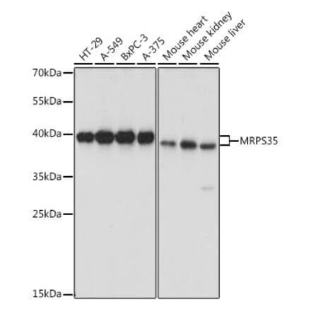 Western Blot - Anti-MRPS35 Antibody (A89543) - Antibodies.com