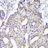 Immunohistochemistry - Anti-MRPS35 Antibody (A89543) - Antibodies.com