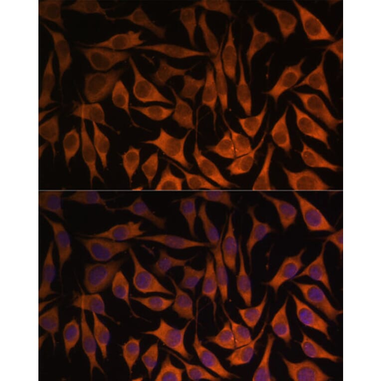 Immunofluorescence - Anti-MRPS35 Antibody (A89543) - Antibodies.com