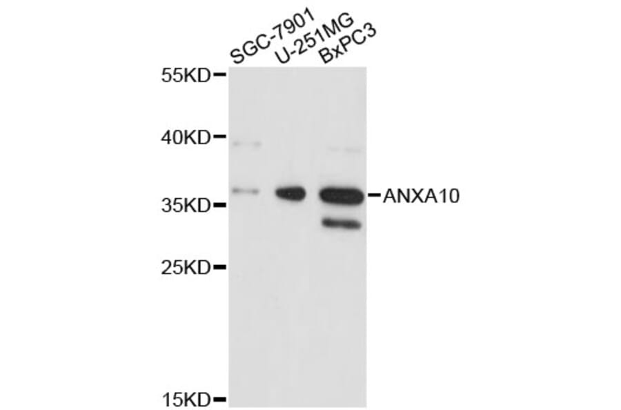 Western Blot - Anti-ANXA10 Antibody (A4492) - Antibodies.com