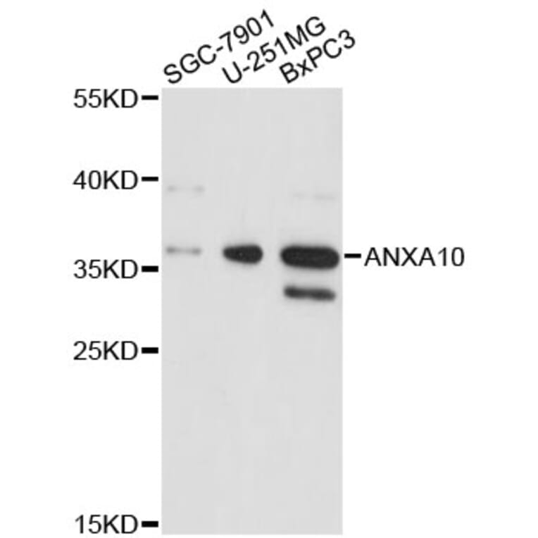 Western Blot - Anti-ANXA10 Antibody (A4492) - Antibodies.com