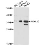 Western Blot - Anti-ANXA10 Antibody (A4492) - Antibodies.com
