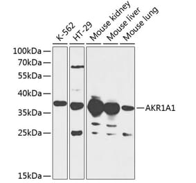 Western Blot - Anti-AKR1A1 Antibody (A89545) - Antibodies.com