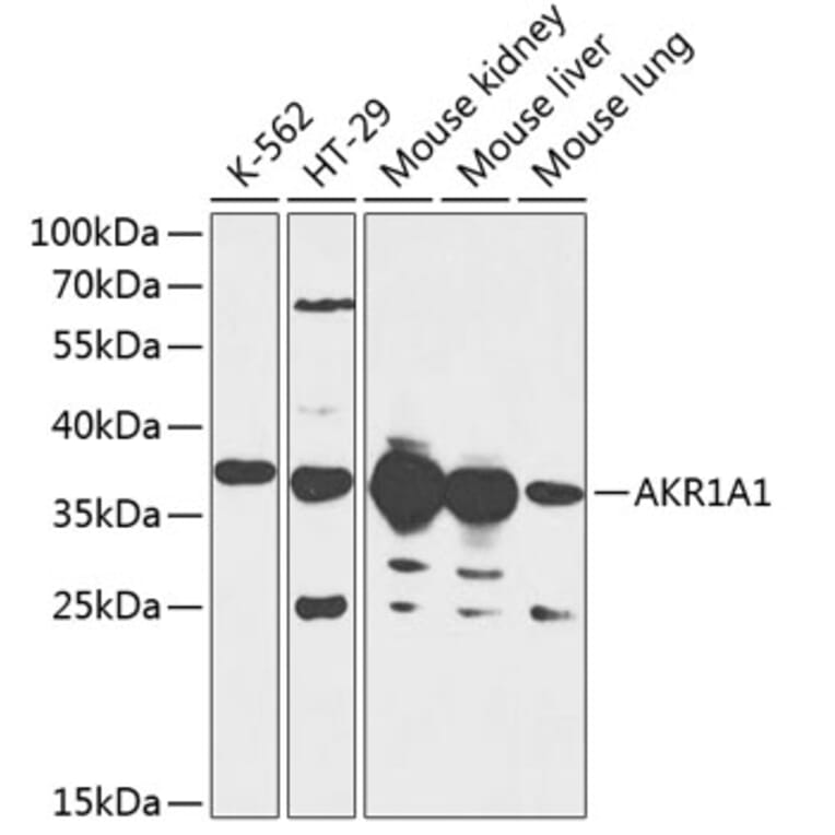 Western Blot - Anti-AKR1A1 Antibody (A89545) - Antibodies.com