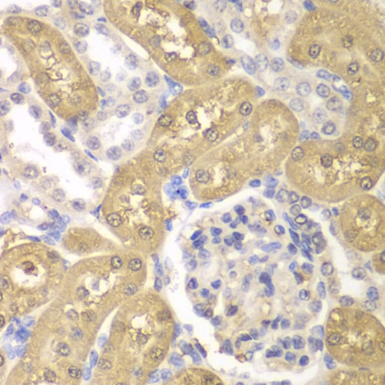 Immunohistochemistry - Anti-AKR1A1 Antibody (A89545) - Antibodies.com