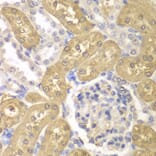Immunohistochemistry - Anti-AKR1A1 Antibody (A89545) - Antibodies.com