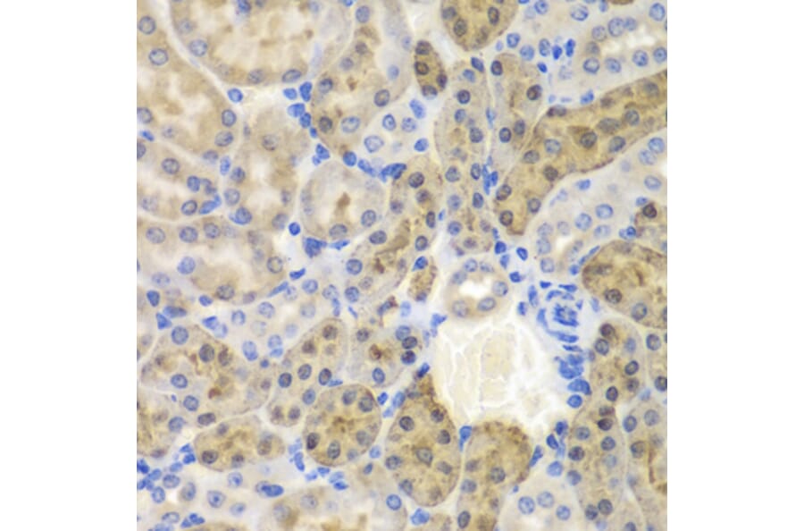 Immunohistochemistry - Anti-AKR1A1 Antibody (A89545) - Antibodies.com
