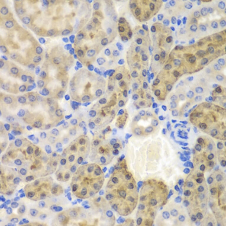 Immunohistochemistry - Anti-AKR1A1 Antibody (A89545) - Antibodies.com