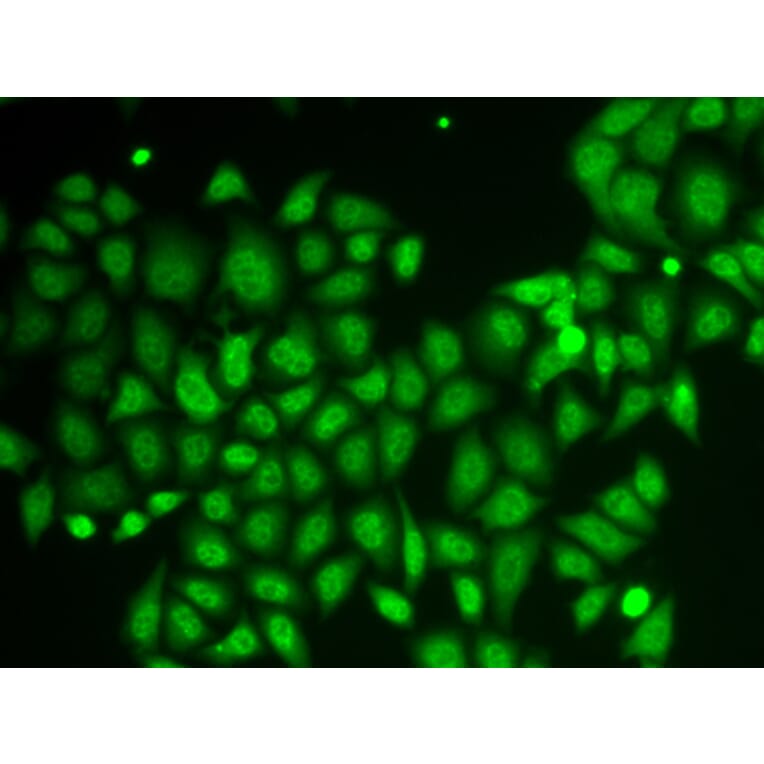 Immunofluorescence - Anti-AKR1A1 Antibody (A89545) - Antibodies.com