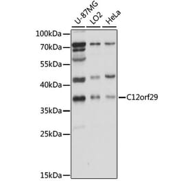 Western Blot - Anti-RLIG1 Antibody (A89546) - Antibodies.com