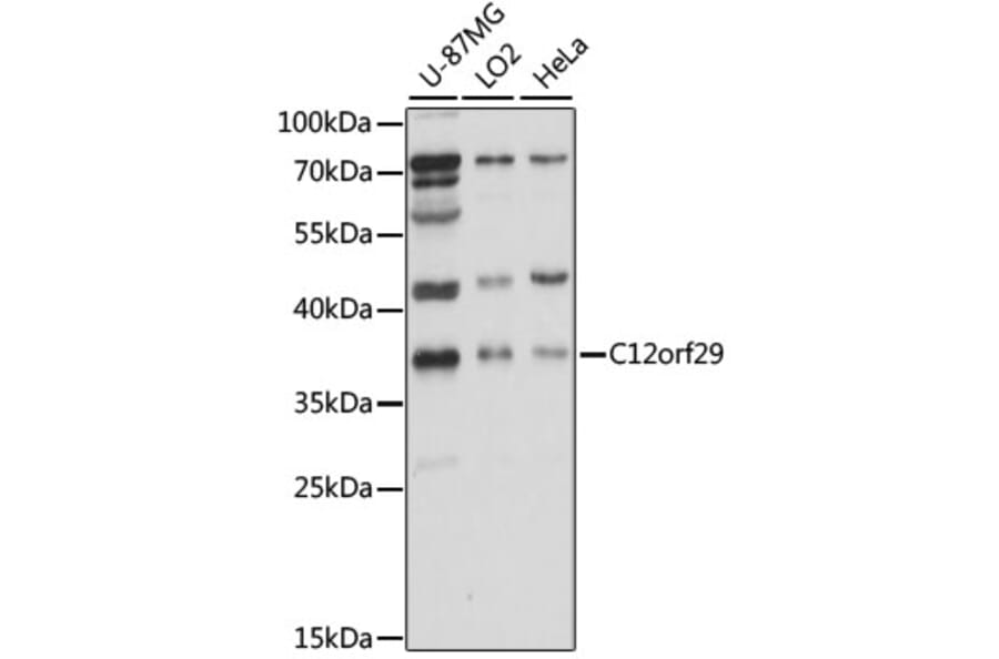 Western Blot - Anti-RLIG1 Antibody (A89546) - Antibodies.com